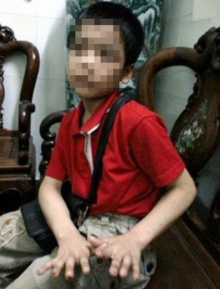 Police arrest couple for child abuse - 1