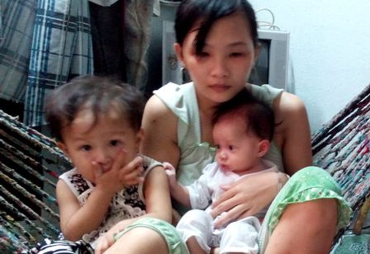 Baby suffers chronic pneumonia and heart disease - 3