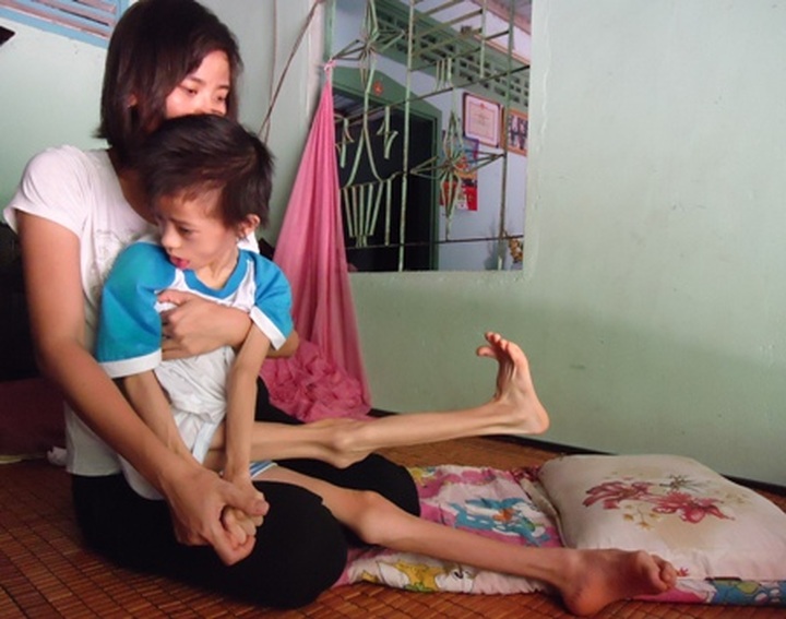 Little girl suffers from undiagnosed diseases - 1