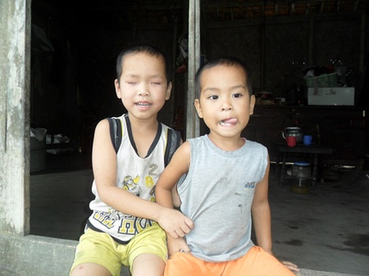 Young blind boy lives hard life near forest - 1
