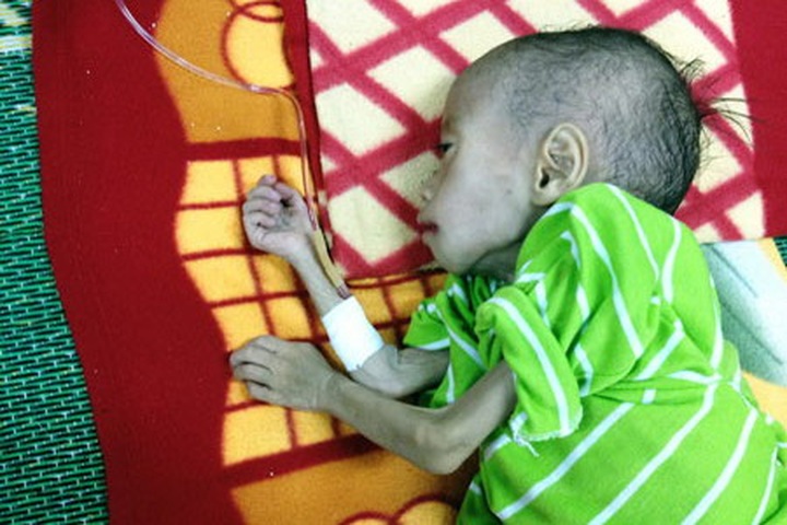 Vietnam hospital says anemic 3-year-old boy has AIDS - 1