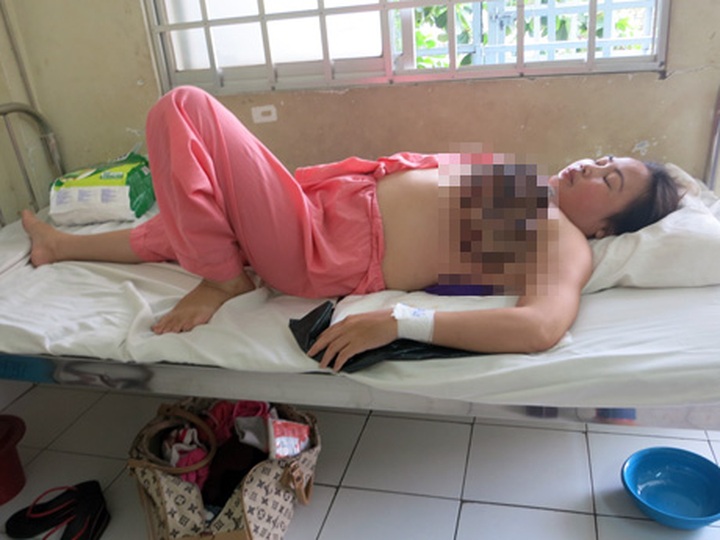 Poor woman with breast cancer abandoned by husband - 1 Poor woman with breast cancer abandoned by husband - 1