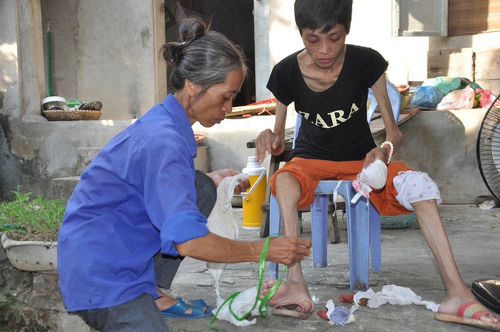 Mother emaciated after years of illness - 2