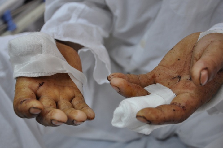 Man loses eyesight in bear attack - 2