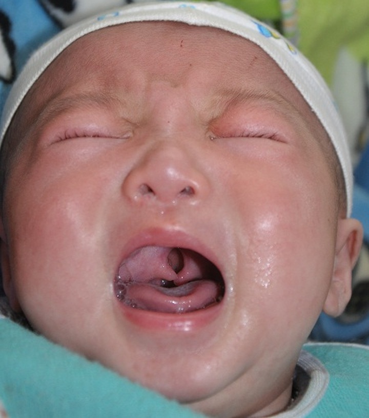 Five-month old boy born with deformities in need of help - 1 Five-month old boy born with deformities in need of help - 1