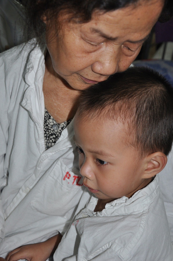 Orphaned boy has unequal leg length because of osteoarthritis - 1