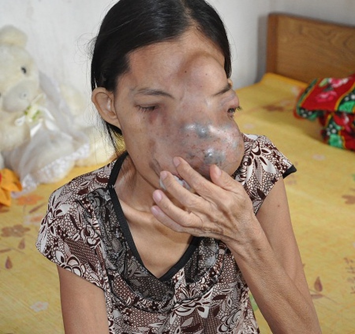 Readers support woman with facial deformities - 1