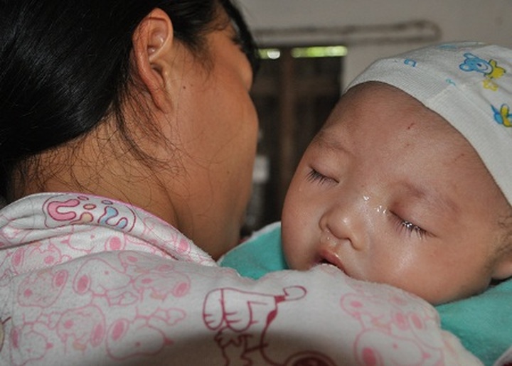 Five-month old boy born with deformities in need of help - 2 Five-month old boy born with deformities in need of help - 2