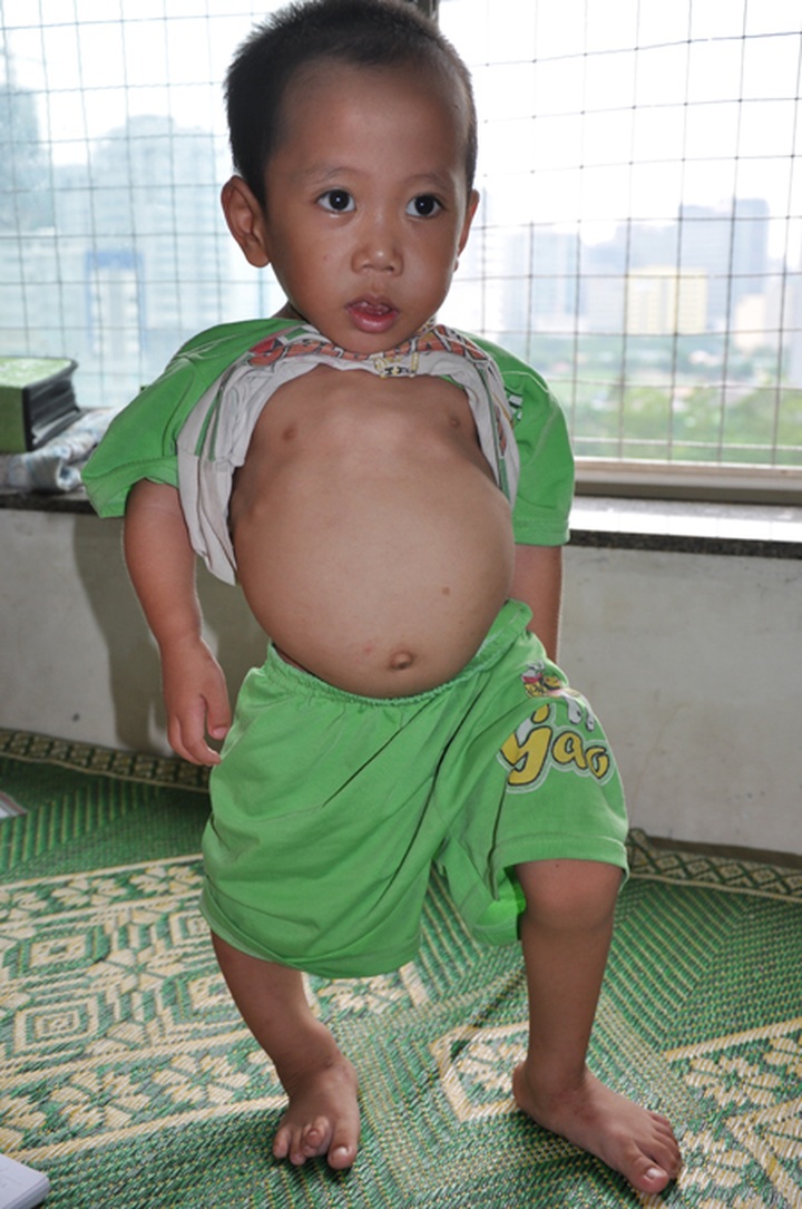 Couple powerless in face of children’s serious diseases - 1