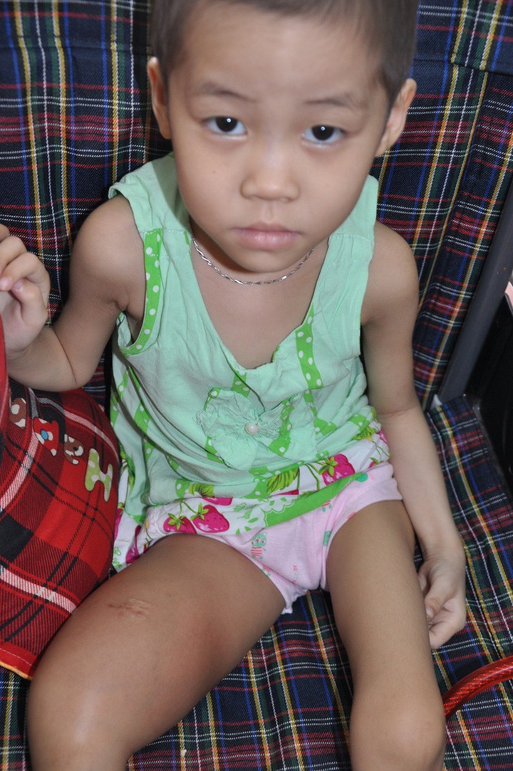 Little girl begs to keep her leg from being amputated - 1