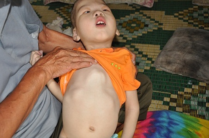 Elderly couple raises abandoned grandson - 1