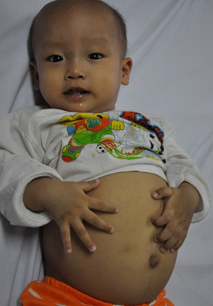 Poor couple powerless to save son from blood cancer - 2 Poor couple powerless to save son from blood cancer - 2