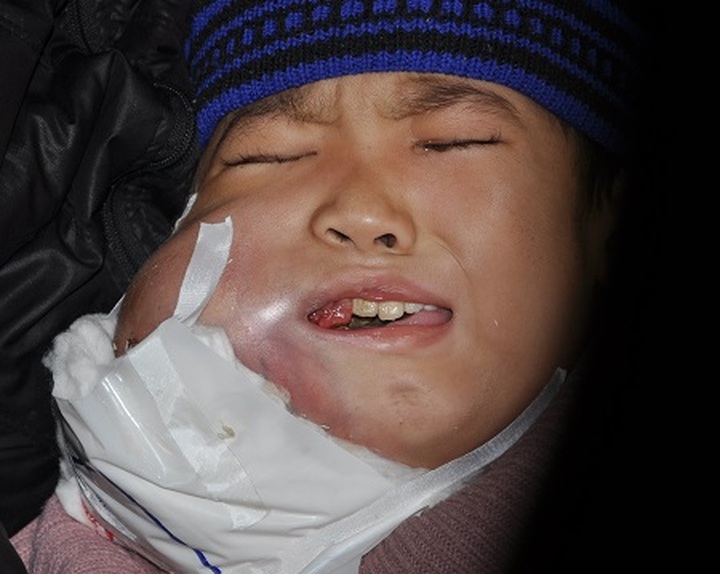 Farther, son in losing battle against cancer - 1