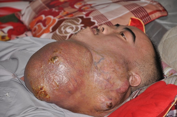 Poor man with lethal tumour seeks help to send his kids to school - 1