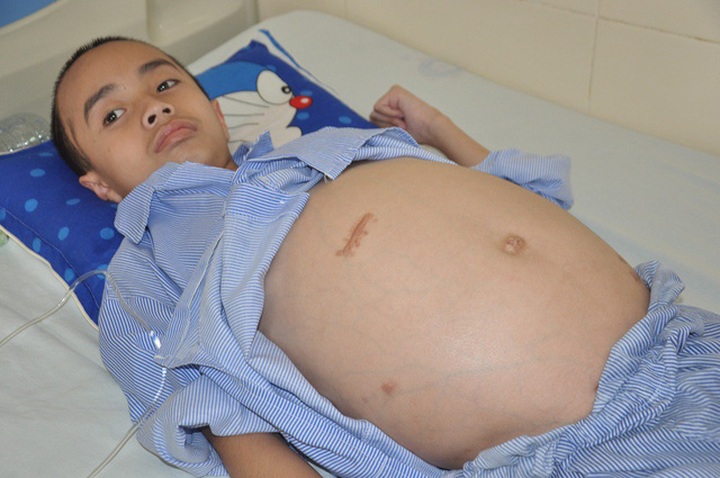 Boy facing fourth brain operation seeks help - 1