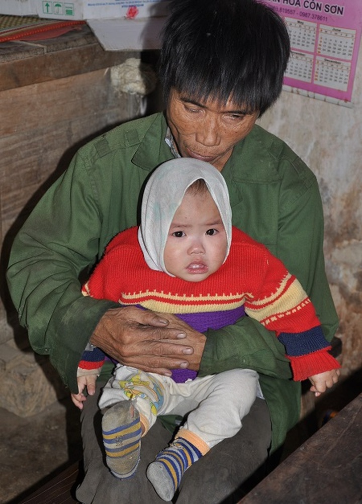 Near blind mother sings to support ill twins - 3