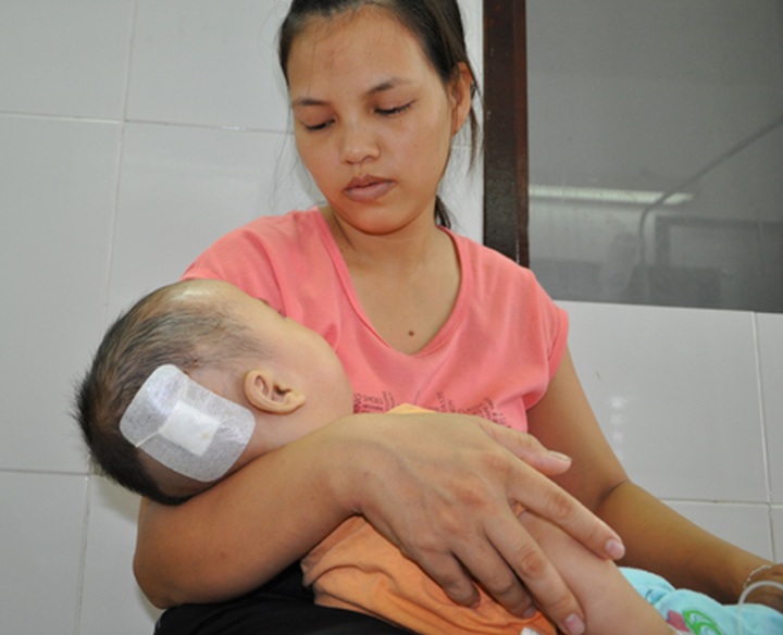 Baby struggles with hydrocephalus - 3 Baby struggles with hydrocephalus - 3