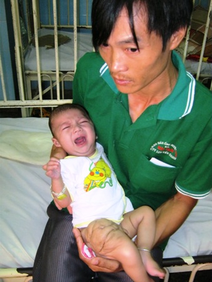 Little baby fighting tumour in leg - 2 Little baby fighting tumour in leg - 2