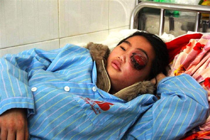 DTiNews readers support girl with eye deformity - 2