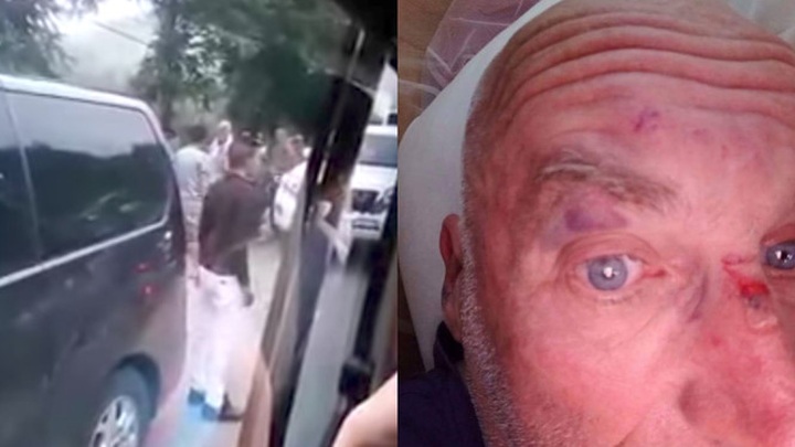 Foreigner attacked by five men says it was his fault - 1