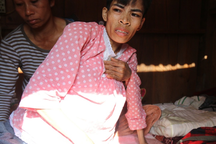 Single mother on verge of death seeks help - 1 Single mother on verge of death seeks help - 1