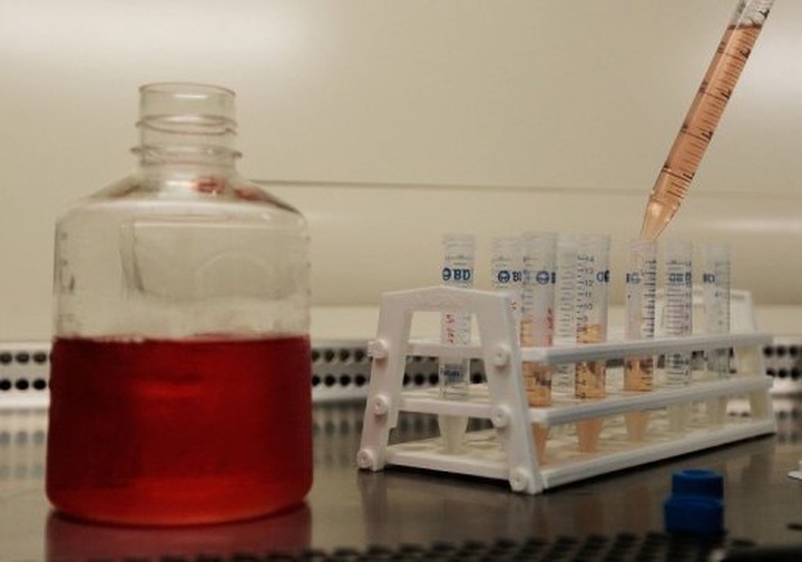 'Gap' for HIV vaccine efforts after latest setback - 1