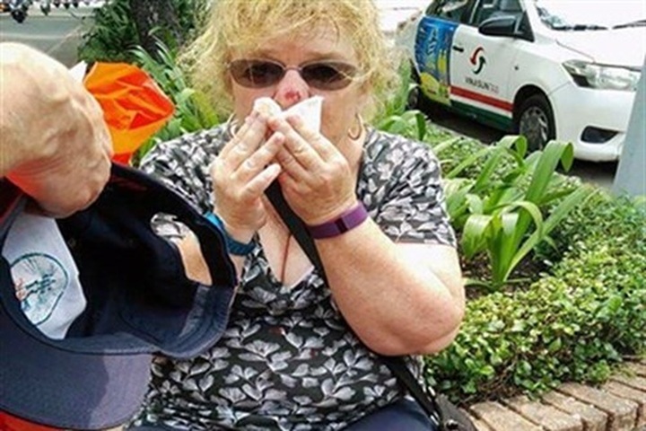 Tourist to get USD1,000 compensation for fall - 1