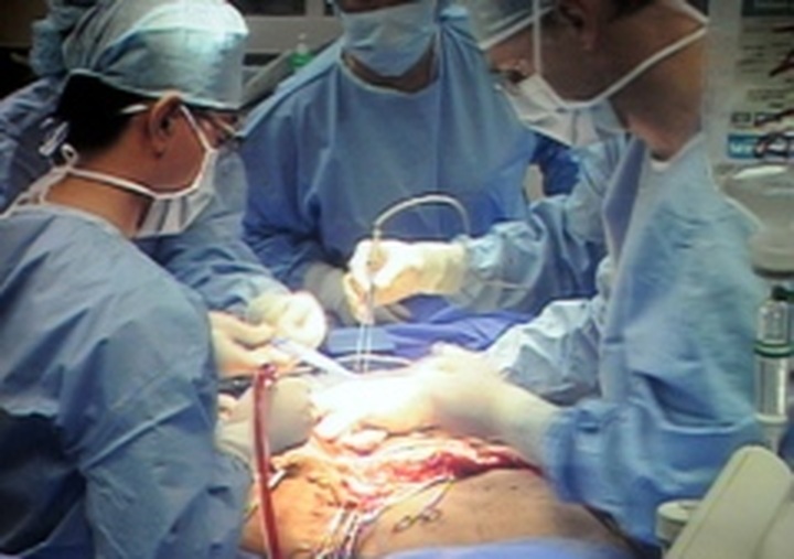 Vietnam man's giant tumor surgery a success - 1