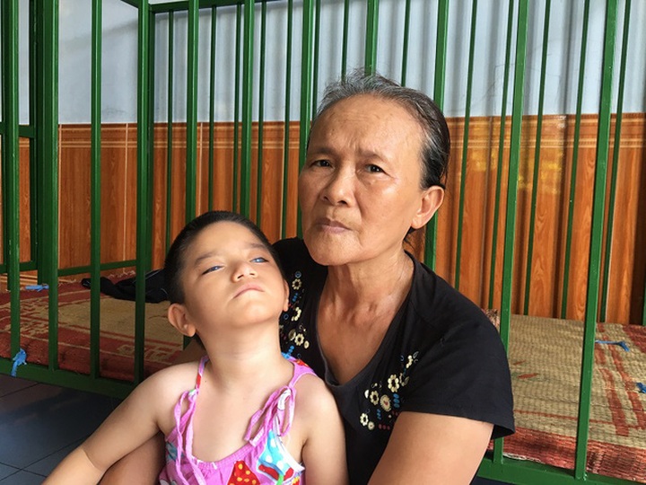 Little girl suffer from cataracts - 1