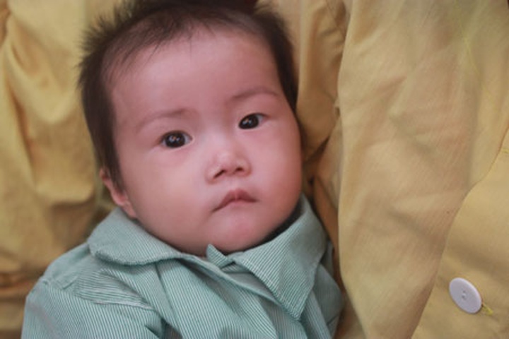 Heart procedures provided for the most needy - 2