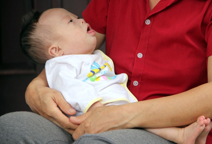 Malnourished baby fighting heart disease to survive - 3 Malnourished baby fighting heart disease to survive - 3