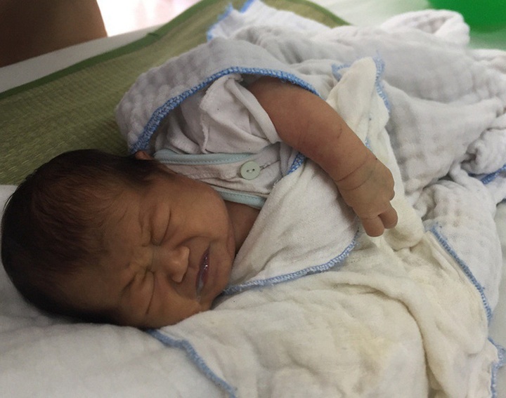 20-day-old baby suffers from heart disease - 1