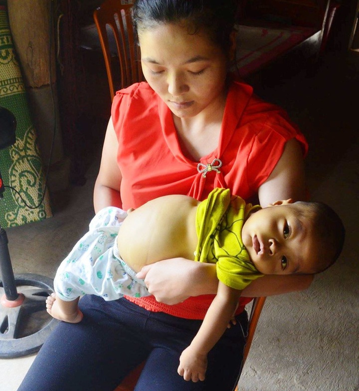 Little boy faces death risk due to serious diseases - 1 Little boy faces death risk due to serious diseases - 1