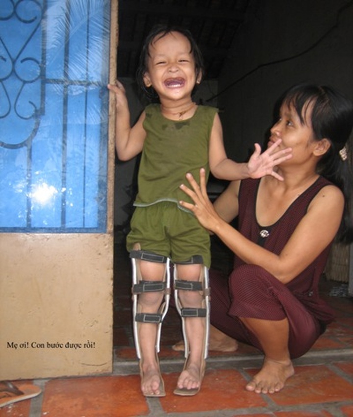 Charities change AO/dioxin victims’ lives - 2