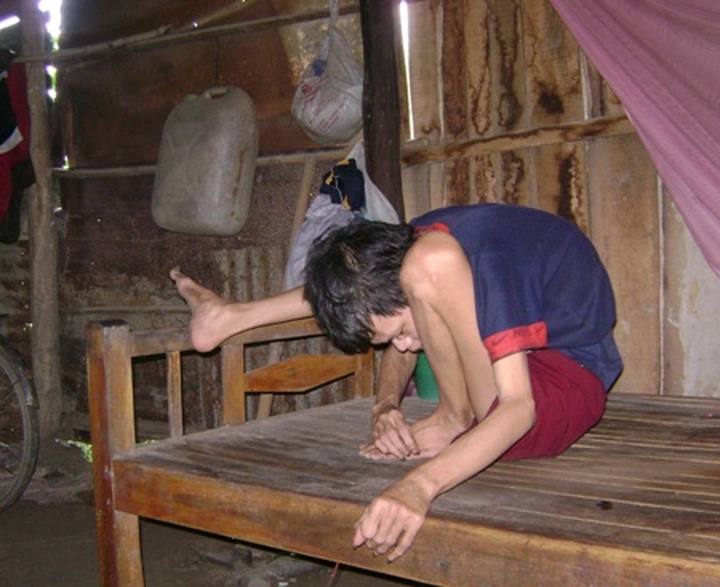 New centre for Agent Orange victims in Quang Ngai - 1