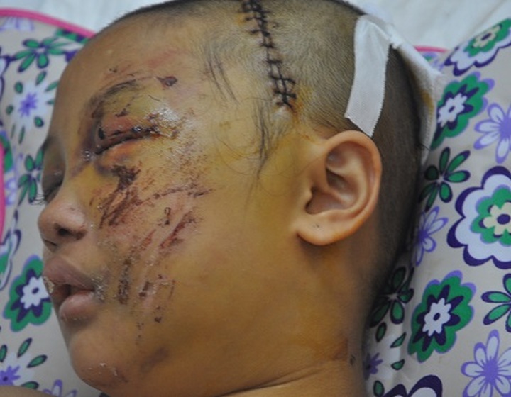 11 year-old girl injured after tragic accident - 1