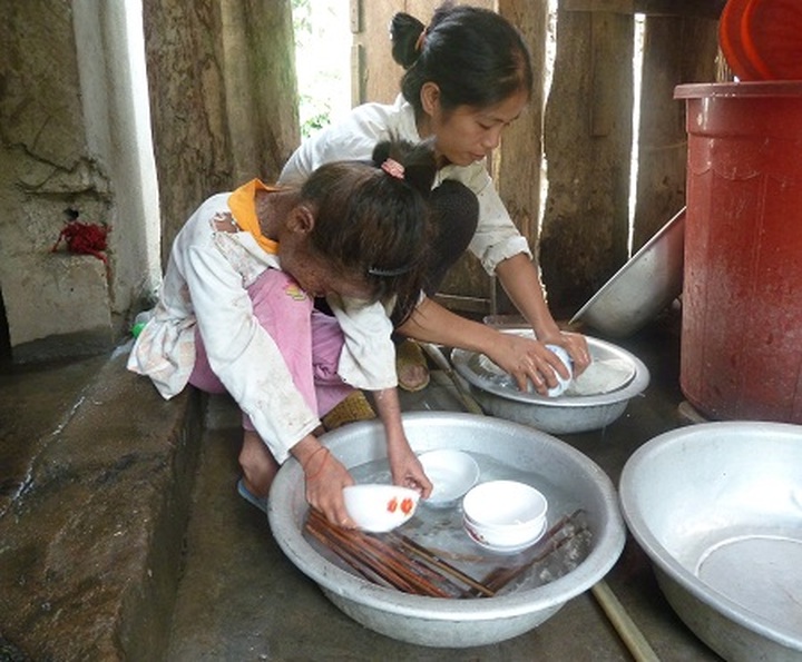 Help comes to little girl with strange skin disease - 2 Help comes to little girl with strange skin disease - 2