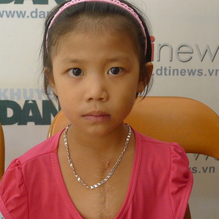 6-year-old girl suffers from heart disease - 1