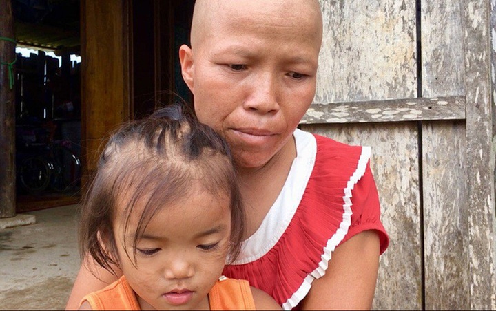 Ill couple calls for help for small children - 1 Ill couple calls for help for small children - 1