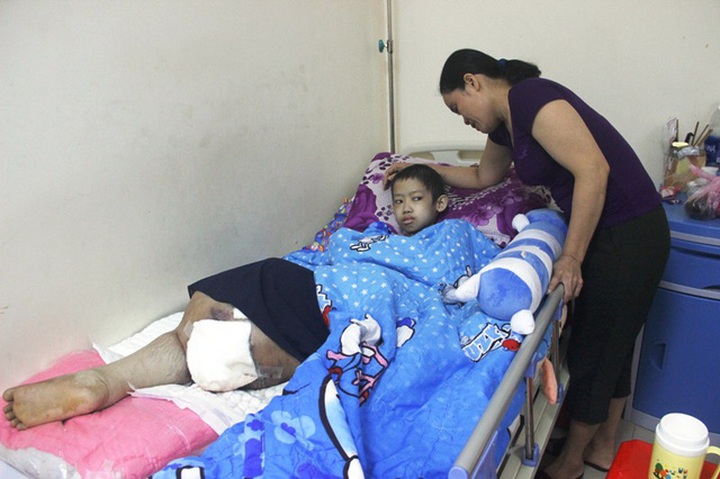 Poor boy struggling with bone cancer calls for help - 1 Poor boy struggling with bone cancer calls for help - 1