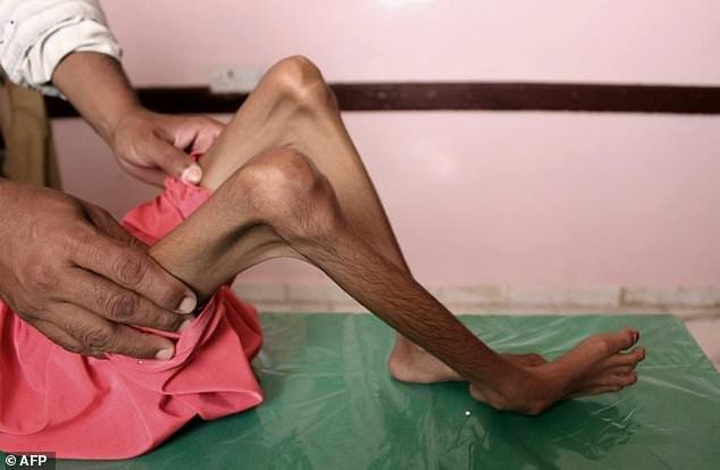 One civilian killed every three hours in Yemen: Oxfam - 1