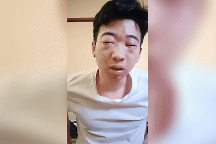 Vietnamese workers quit high-paying jobs in Japan due to hay fever - 1