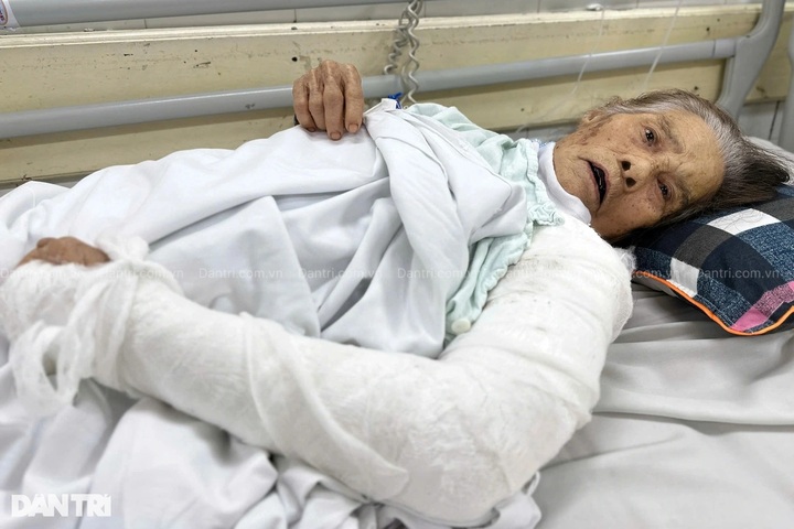 Family of critically injured ninety-year-old woman appeal for help - 1