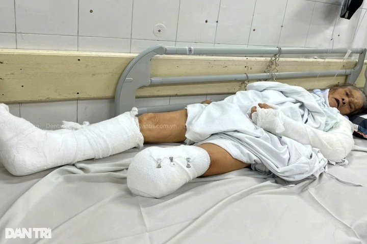 Family of critically injured ninety-year-old woman appeal for help - 2