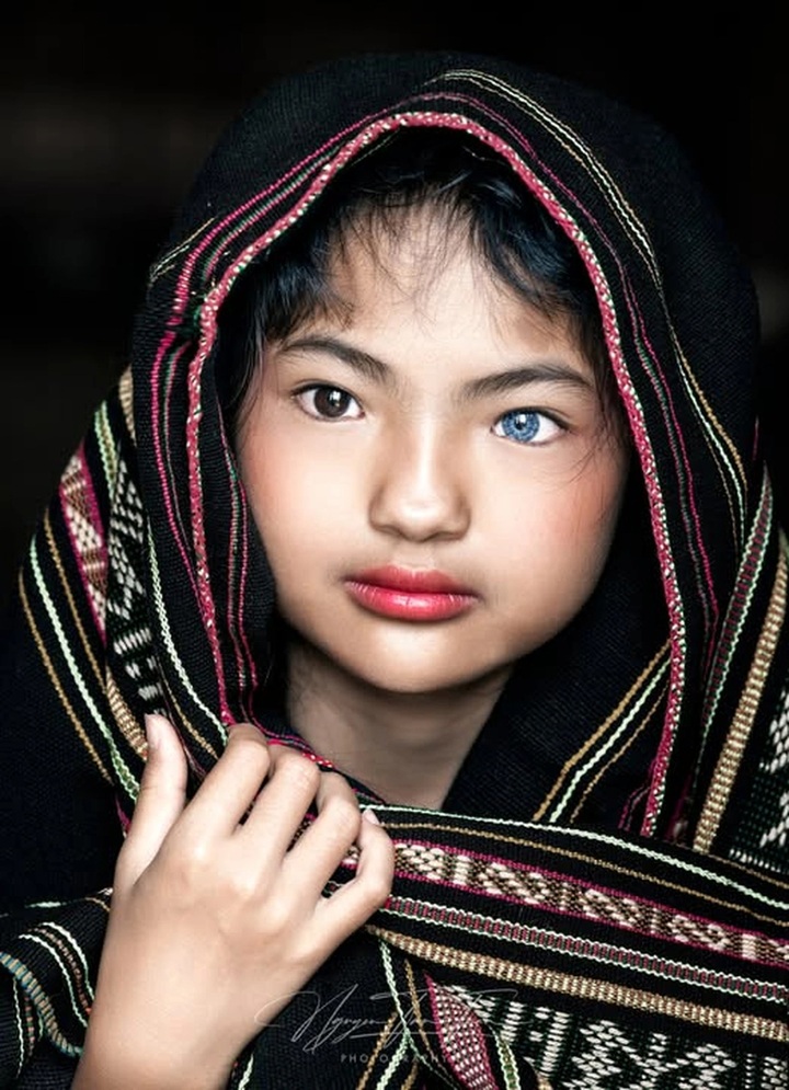 Dak Lak girl stuns with two-coloured eyes - 1 Dak Lak girl stuns with two-coloured eyes - 1