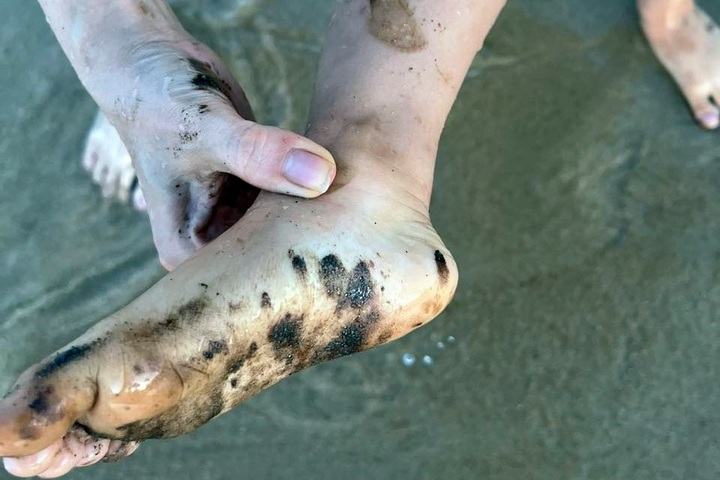 Oil slicks stain tourists’ feet at Tuy Hoa beach - 1 Oil slicks stain tourists’ feet at Tuy Hoa beach - 1