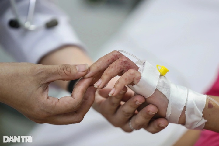 Three dead as dengue outbreak worsens in Ho Chi Minh City - 1