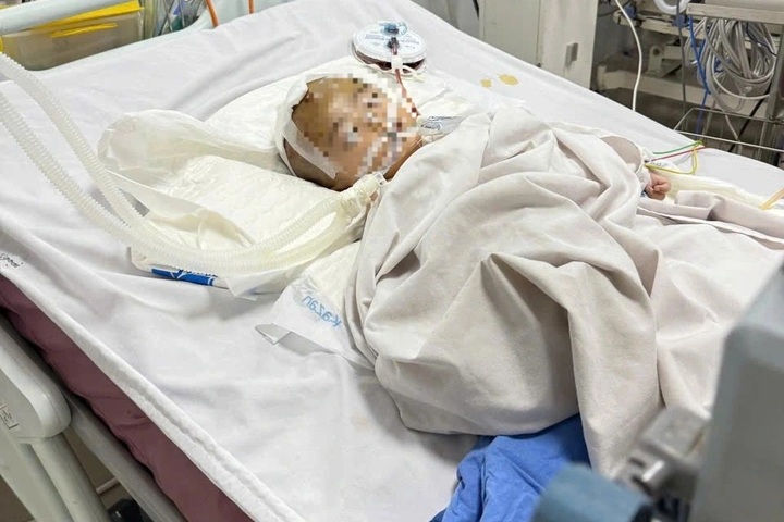 Quang Ngai toddler dies following being abused by babysitter - 1