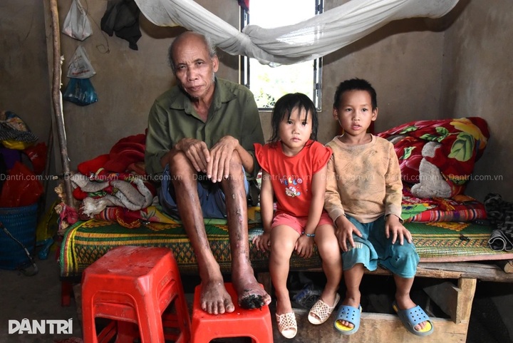 Father of five in Dien Bien needs urgent help for diabetes treatment - 1