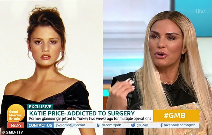 Katie Price tiếp tục làm đẹp bằng dao kéo - Ảnh 3. Katie Price tiếp tục làm đẹp bằng dao kéo - Ảnh 3.